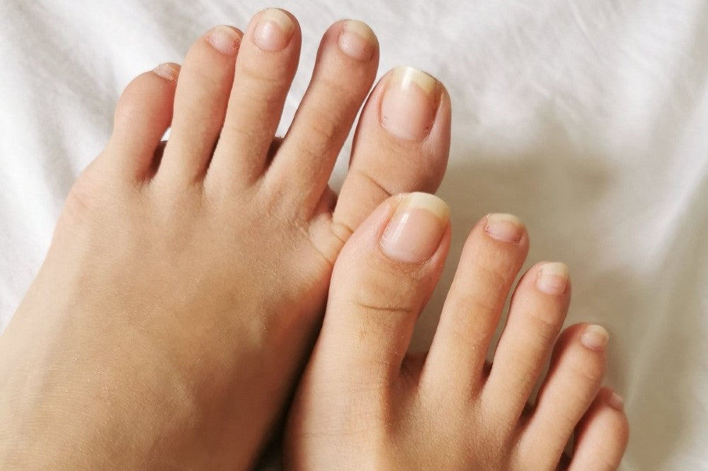 Stop Fungus in Its Tracks! The Science Behind Toenail Debridement